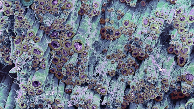 Los virus antiguos ayudaron a evolucionar los nervios rápidos