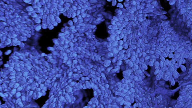 Curso de posgrado «Microscopía de fluorescencia cuantitativa y procesamiento de imágenes tridimensionales»