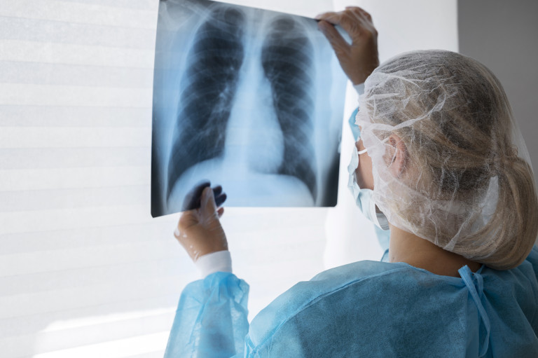 Investigadores argentinos desarrollan una herramienta contra la tuberculosis